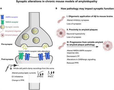 Alzheimer’s disease as a synaptopathy: Evidence for dysfunction of synapses during disease progression